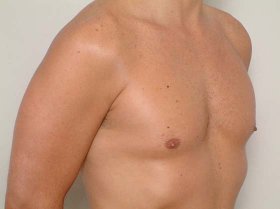 torso