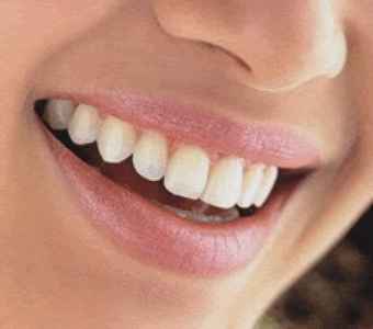 Sonrisa perfecta 1
