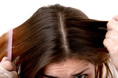 Tratamiento para quitar piojos. 1