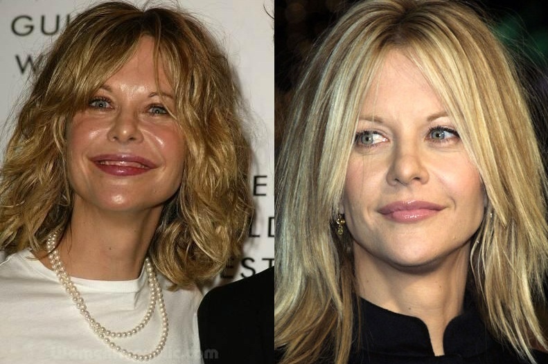 meg ryan antes y después