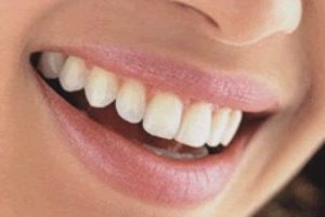 ¿Qué significa soñar con los dientes?