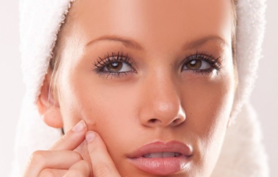 problemas de acne