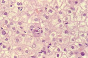Conoce al citomegalovirus 7