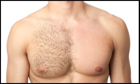 depilacion masculina