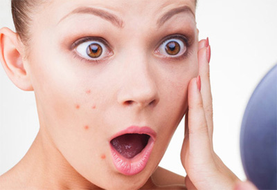 problemas de acne