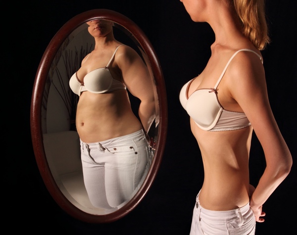 anorexia