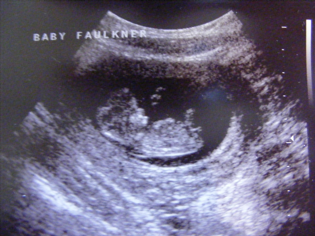 Semana 14 embarazo