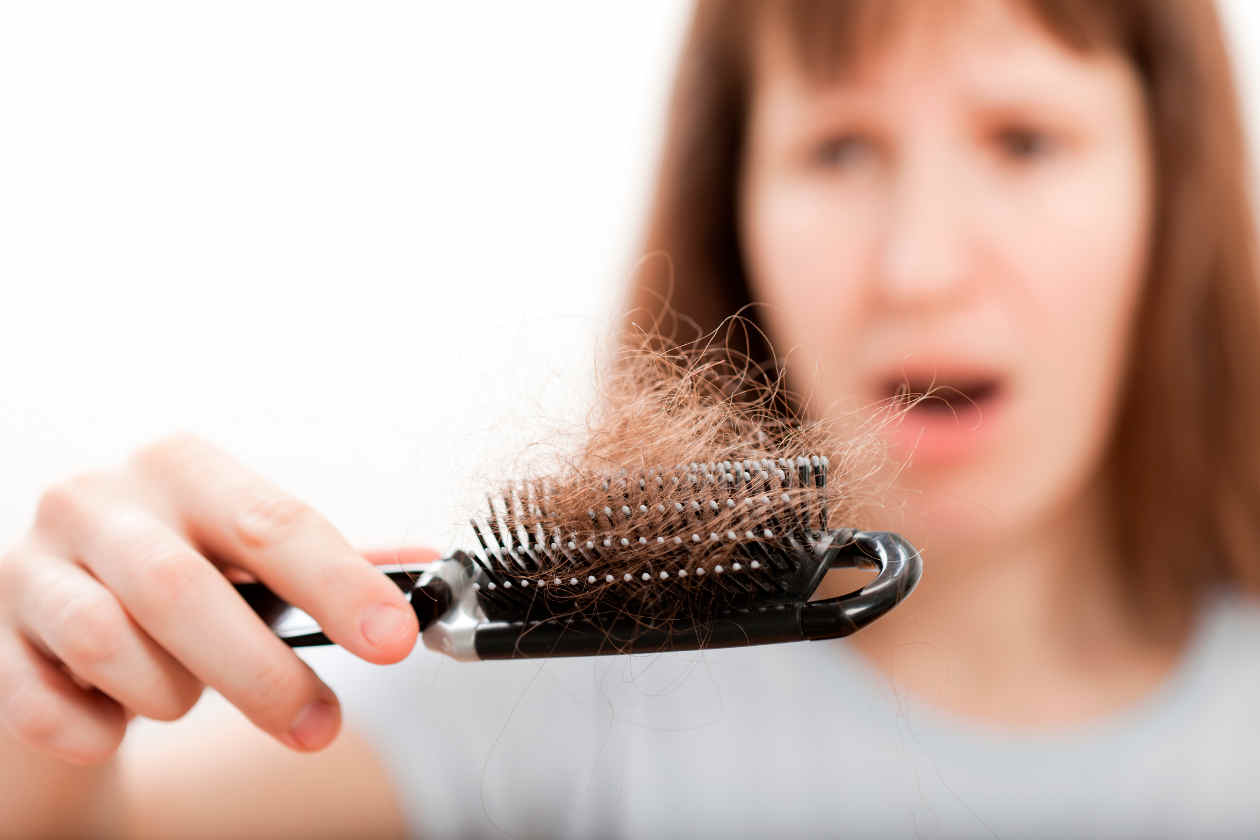 alopecia en mujeres